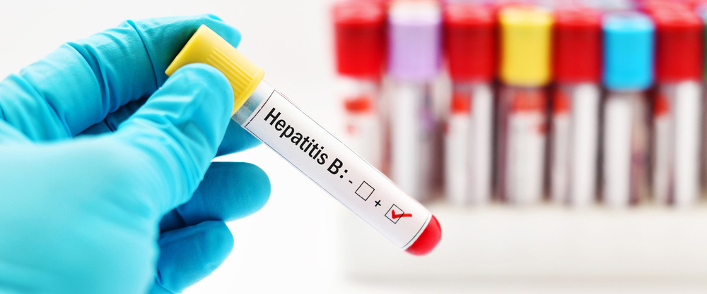 Quid est Hepatitis B? Quae sunt symptomata et curationes modi?